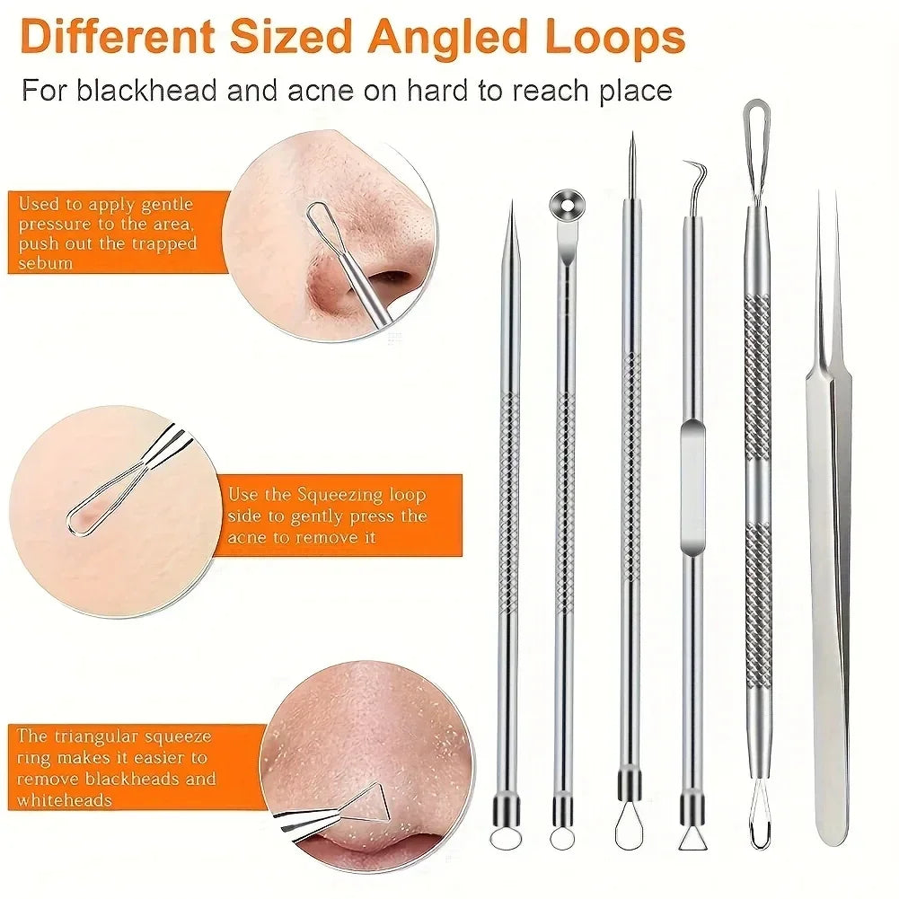 Set of different sized angled loops for blackhead and acne removal with usage instructions.
