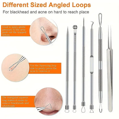 Set of different sized angled loops for blackhead and acne removal with usage instructions.